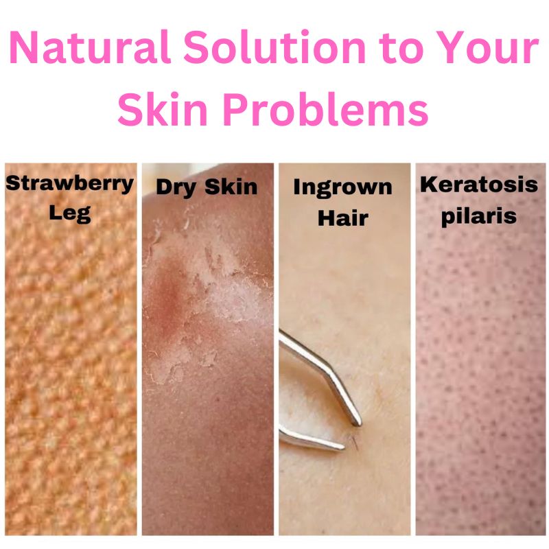 Natural exfoliator for strawberry leg dry skin ingrown hair and keratosis pilaris