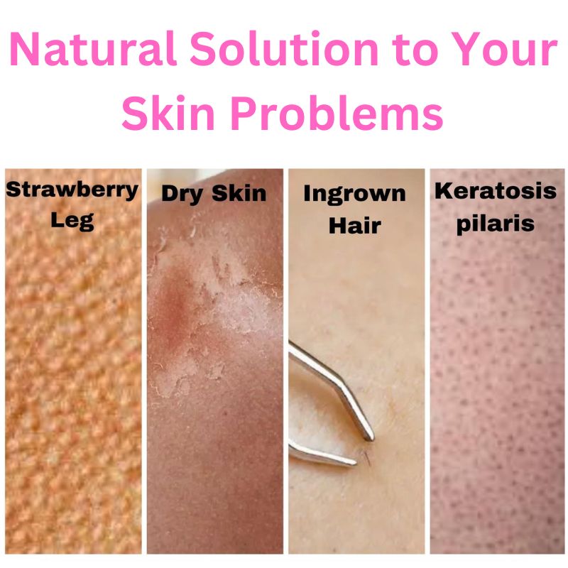 Natural exfoliator for strawberry leg dry skin ingrown hair and keratosis pilaris