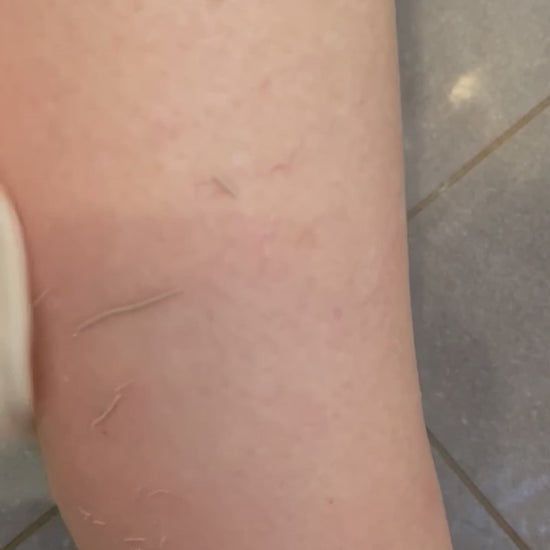 dead skin being exfoliated off woman's leg  fix keratosis pilaris  scrub shower