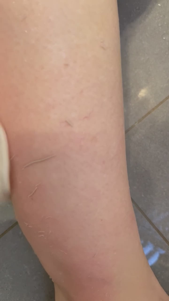 dead skin being exfoliated off woman's leg  fix keratosis pilaris  scrub shower